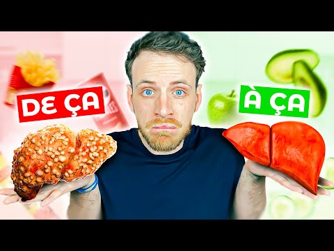 TOP 6 aliments contre le FOIE GRAS