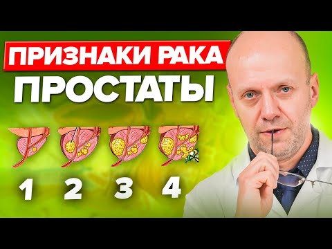 Рак простаты НЕ ПРИГОВОР! Просто обрати внимание на ЭТИ СИМПТОМЫ...