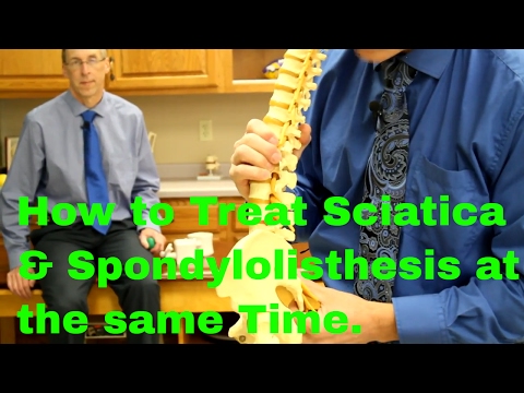 How Do You Treat Sciatica & Spondylolisthesis? (At the Same TIme)