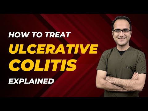 Ulcerative Colitis Treatment Explained, Acute Severe Colitis Medicine Lecture USMLE Neetpg Part 2
