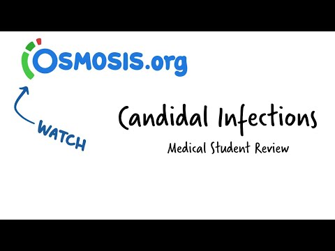 Candidal Infections: Osmosis Study Video