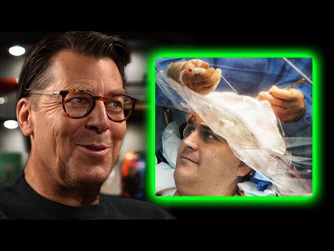 The Wild Reason Brain Surgery Is Done While You’re Awake | Dr. Brian Hoeflinger