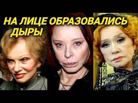 ШОКИРУЮЩИЕ неудачные пластические операции звёзд ДО и ПОСЛЕ