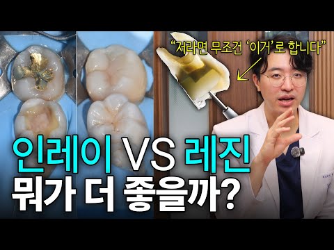 “요즘 최신 치료는 이겁니다” l 충치치료 받기 전 보고가세요