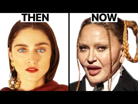 Madonna Plastic Surgeries - Surgeon Reacts