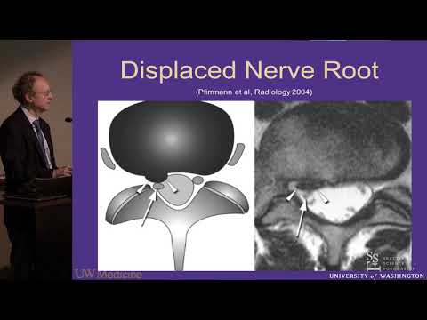 Lumbar MRI:  What the Findings Mean and How They Should Be Reported - J. Jarvik, MD, MPH
