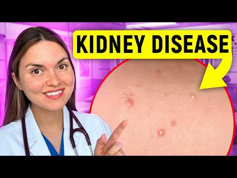 17 Signs of KIDNEY DISEASE You Can See: Doctor Explains