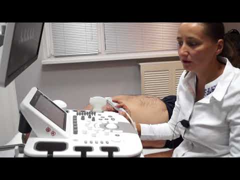 Вебинар "Ультразвуковая диагностика поражения сонных артерий" (запись мастер-класса 27.09.17)