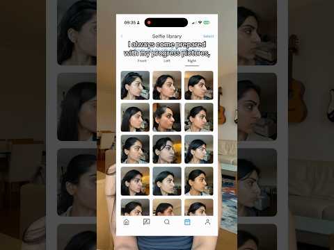 Search for “Clear skincare” on the App Store if you want a gold star too ⭐️ #acne #skincare #derm