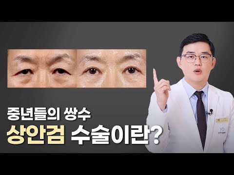 중년들의 쌍수 상안검 수술이란?