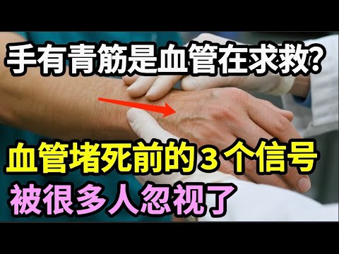手有青筋是血管在求救！？医生警告：再不重视这3种情况，血管随时堵死！【家庭大医生]
