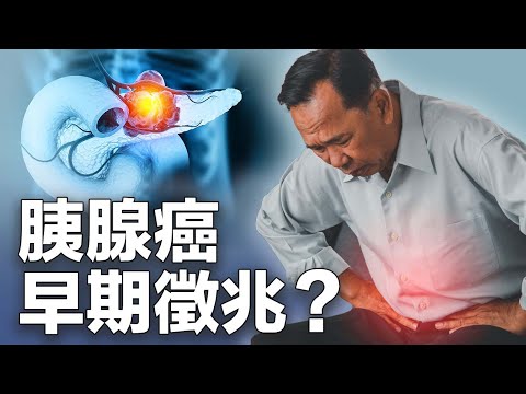 這種不適是胰臟癌早期徵兆？千萬不要等到晚期才發現！