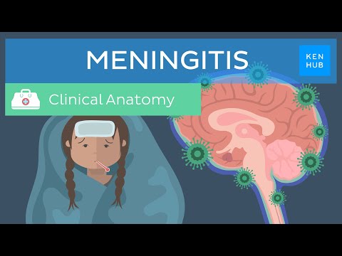 Meningitis: Causes, symptoms, treatment | Kenhub