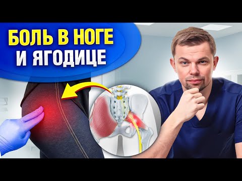 Боль в ягодице, пояснице и ноге — ЭТО НЕ СИНДРОМ ГРУШЕВИДНОЙ МЫШЦЫ