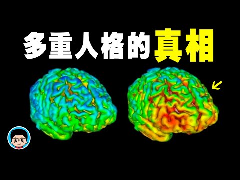 Dissociative disorders - causes, symptoms, diagnosis. Billy Milligan: 24 Different Personalities