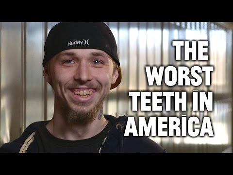 Mountain Dew Mouth and the Worst Teeth in America