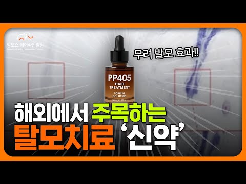 "정말 발모 효과가!?" 해외에서 난리난 탈모 치료 신약 'PP405' 효과는?