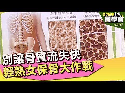 別讓骨質流失快 輕熟女保骨大作戰【57健康同學會】第497集 2012年