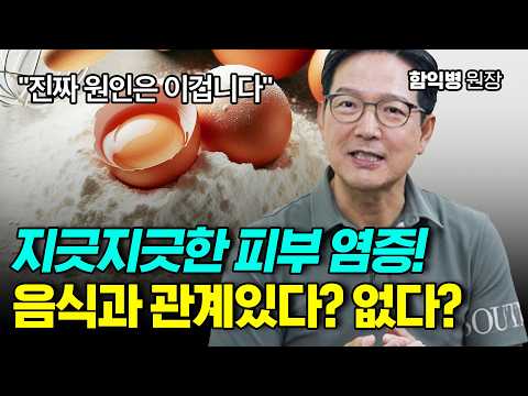 아토피, 여드름, 지루성 피부염에 피해야 할 음식! 탈모 치료법 [함익병 원장]
