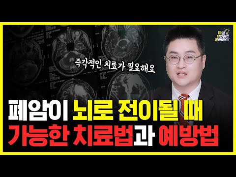 폐암 뇌전이, 더 이상 '말기'가 아니다! | 놓치면 안 되는 치료 시기와 방법