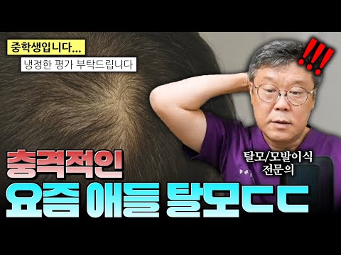 청소년 탈모 요즘 어린나이부터 심각한 수준인 실태