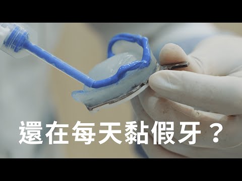 告別傳統假牙，BPS 吸附式假牙讓您重拾美食享受！