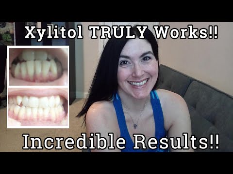 My 12 Month Xylitol Results: Gum Recession Reversed/ Teeth Remineralized!