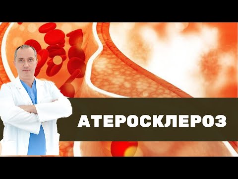 ❤ Что такое атеросклероз на самом деле?