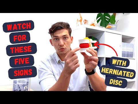 5 Signs a Herniated Disc is Healing
