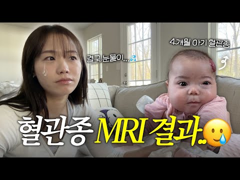 Baby hemangioma MRI results, transferred to a larger hospital in another city, tree decoration 🎄✨...