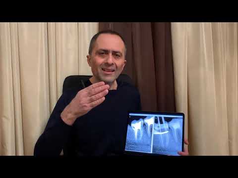 Из клинических обсуждений в Эндоклубе. Закрытый Telegram-канал для эффективного обучения