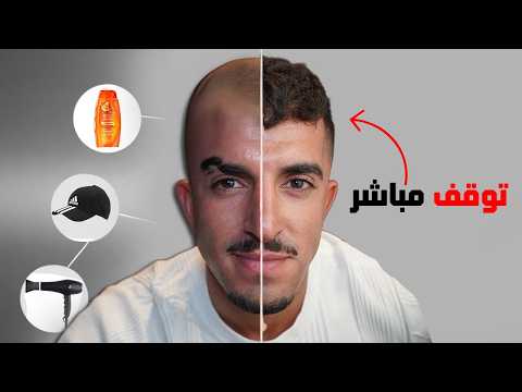 تحذير! 8 عادات يومية تدمّر شعرك (دون أن تدرك ذلك)