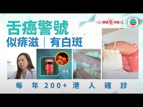 最強生命線｜舌頭潰爛別忽視！揭開舌癌早期警號（繁 / 簡字幕）｜醫療｜治療｜無綫新聞｜TVB News