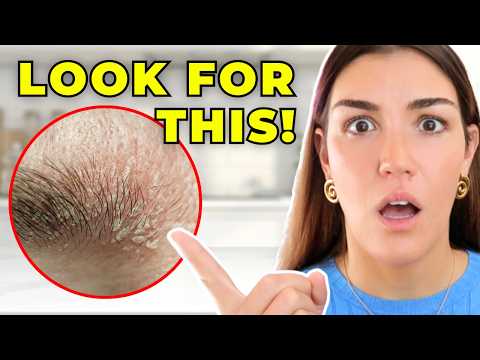 Iodine Deficiency Often Looks Like This. Here’s How to Spot It.