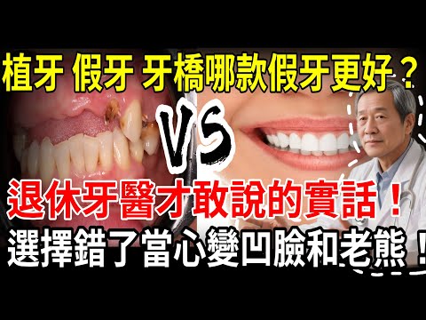 牙齒掉光有救了！別再忍受假牙！頂尖「歐恩四」技術，讓你一天找回真牙，大口吃肉！