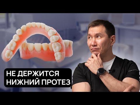 НЕ ДЕРЖИТСЯ НИЖНИЙ полный ПРОТЕЗ! Что делать? Расскажем как сделать так, чтобы он не выпадал