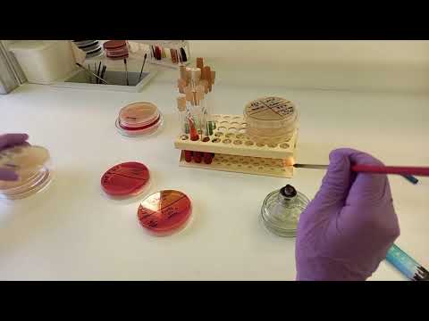 Выделение чистой культуры аэробов. 2-3 этапы