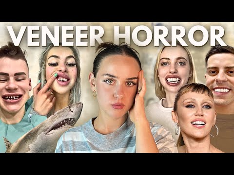 Wie Veneers Gesichter (und Leben) zerstören können