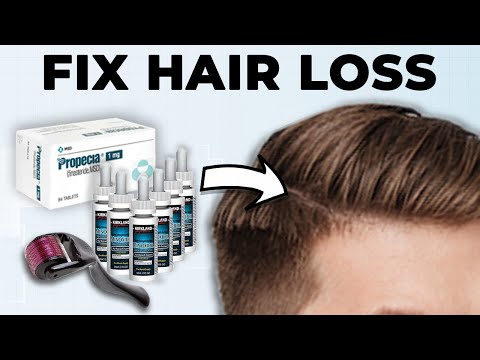 Men: How To Fix Hair Loss At Home (Full Guide)