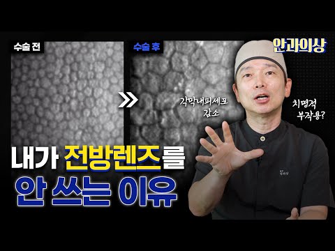 렌즈삽입술 23년차 안과의사가  전방렌즈를 안 쓰는 이유 #렌즈삽입술 #icl #전방렌즈 #후방렌즈 #내피세포