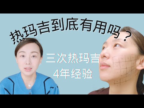 【Anna阿姨 医美分享】三次热玛吉体验总结 | 抗衰老效果如何 | 记录我的第三次热玛吉 Thermage FLX