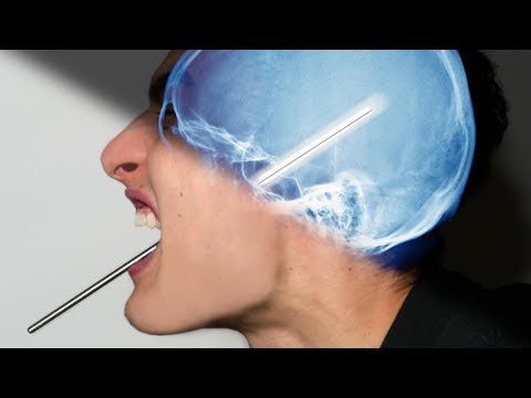 How DANGEROUS are Metal Straws?