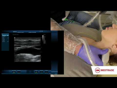 Мастер-класс по УЗ исследованию шейных сегментов сонных позвоночных артерий на Mindray DC-8