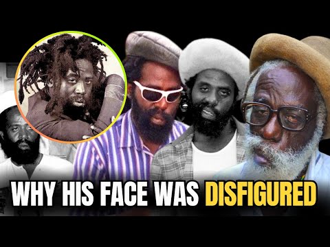 Why Jah Stitch’s Face Was DISFIGURED—A Survival Story Too WILD to Believe