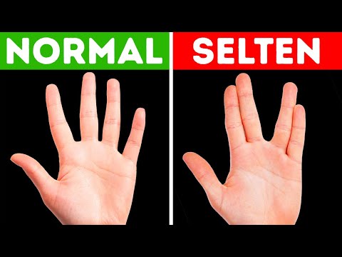 Wenn du das kannst, bist du einmalig unter Million