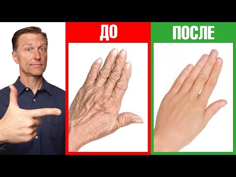 Сухость кожи рук и трещины на руках? Лучшее домашнее средство🔥
