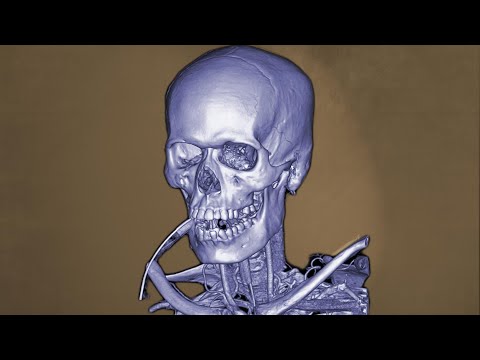 The Body After Eating Several Pounds Licorice Candy