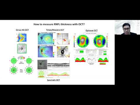 Lecture: How to Interpret OCT Findings in the Diagnostic Evaluation of Glaucoma