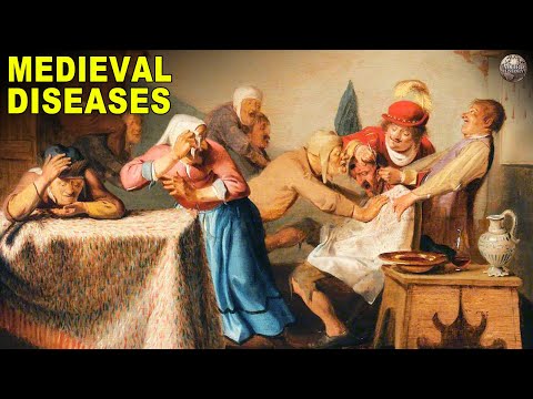 All The Afflictions You Might Have If You Lived In A Medieval City