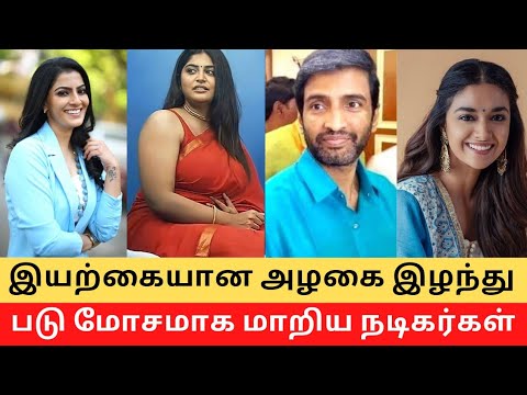 Top 10 Actors Lost their Real Beauty !! || Cinema SecretZ #viralvideo